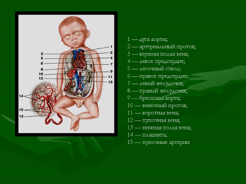 1 — дуга аорты; 2 — артериальный проток; 3 — верхняя полая вена; 4